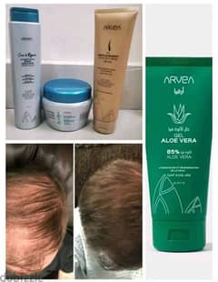 Hair regrowth treatment 0