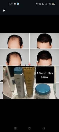 hair regrowth treatment